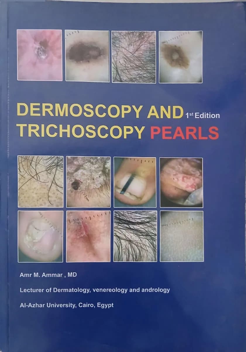 Dermoscopy and Trichoscopy Pearls
