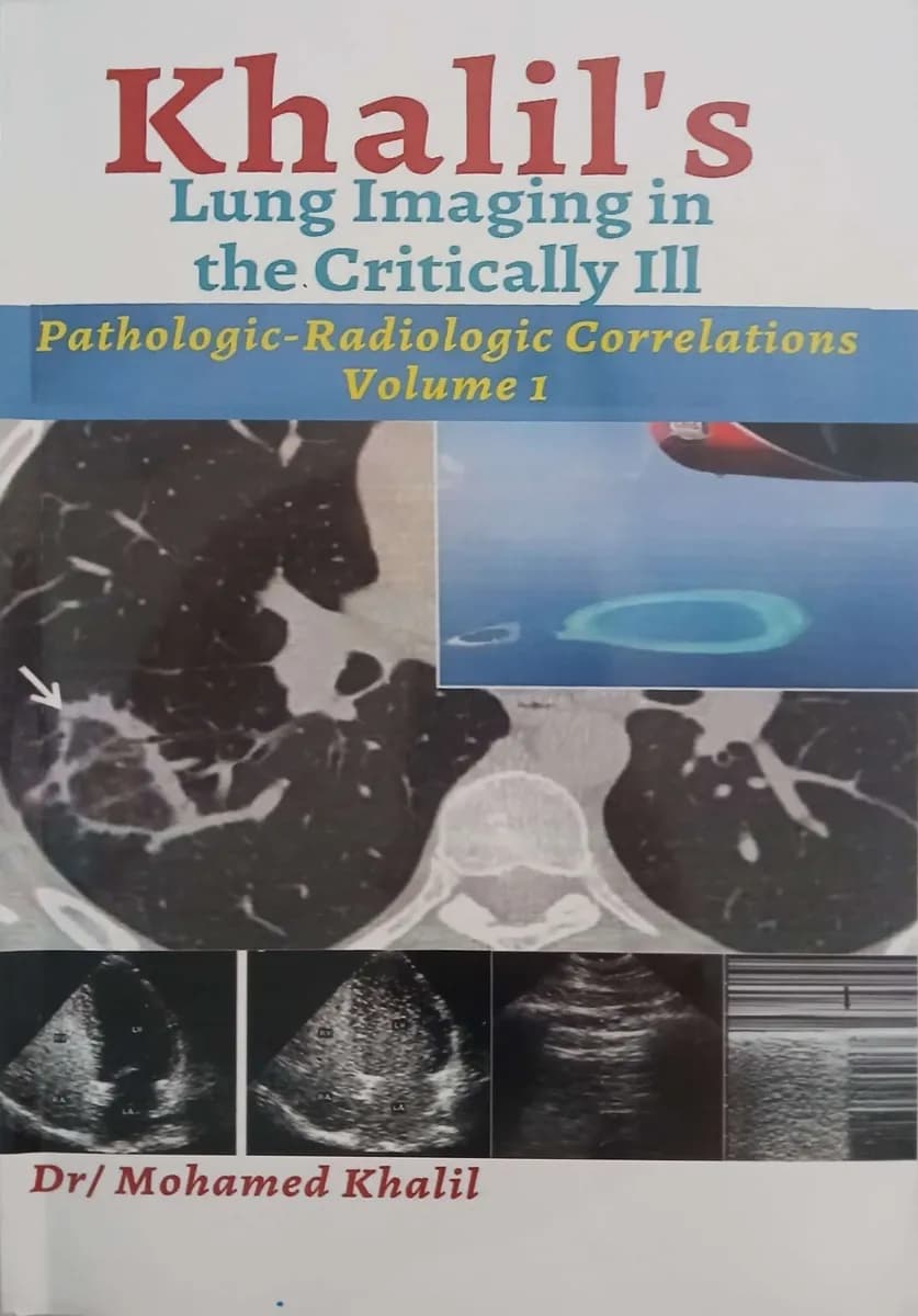 Khalil's Lung Imaging in the Critically Ill Pathologic-Radiologic Correlations  2 Volumes 